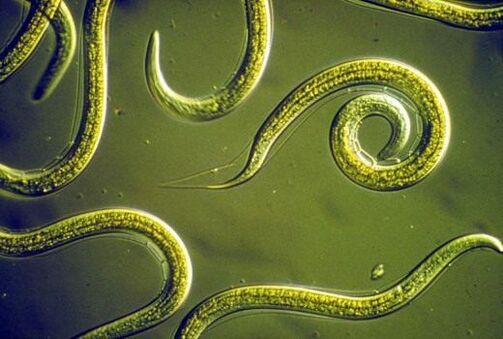 Parazītiskie nematodes tārpi, kas dzīvo cilvēka tievajās zarnās